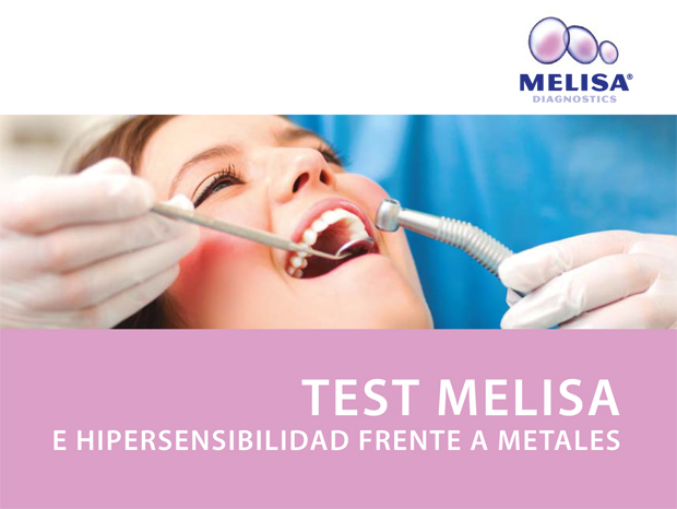 test-melisa-hipersensibilidad-metales